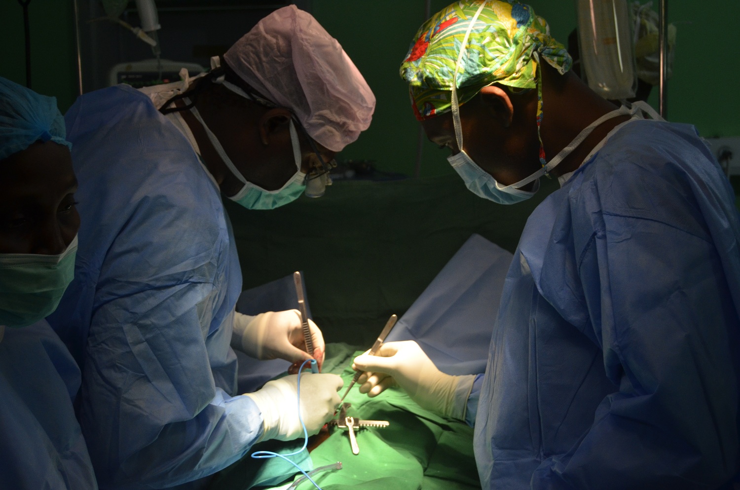 laparoscopy
